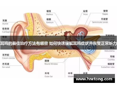 耳鸣的最佳治疗方法有哪些 如何快速缓解耳鸣症状并恢复正常听力